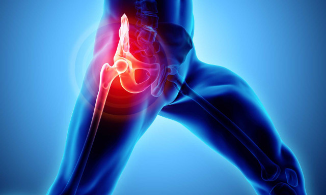 Wenn die Hfte &bdquo;schnappt&ldquo;! - Sprechstunde zum Thema: Hftgelenkbeschwerden