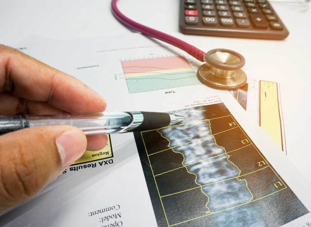 Diagnostik: Methoden zur Früherkennung - Ein Arzt analysiert das Röntgenbild der Wirbelsäule eines Patienten mit einem Stethoskop auf dem Tisch.