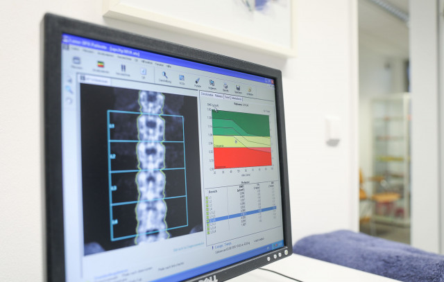 Knochendichtemessung - Auf einem Computermonitor ist ein detaillierter Wirbelsäulenscan abgebildet, der wichtige neurologische Informationen darstellt.