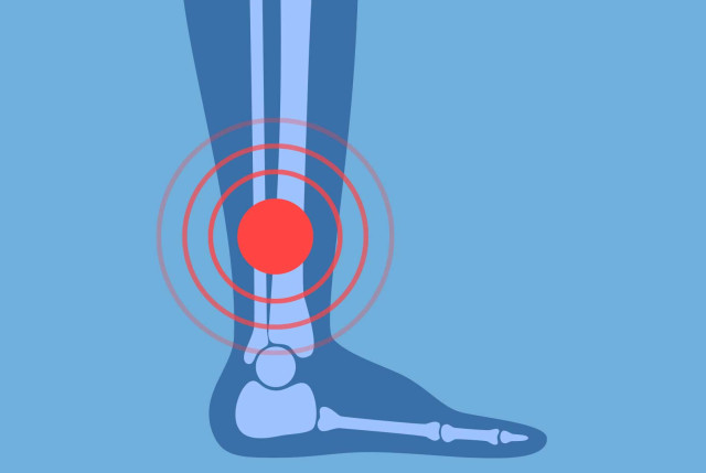 Fuß - Vereinfachte anatomische grafische Darstellung des Fuss mit roter Signal-Markierung
