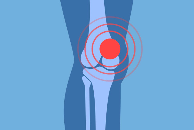 Knie - Vereinfachte anatomische grafische Darstellung des Knies mit roter Signal-Markierung